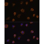 Immunofluorescence - Anti-MMP13 Antibody (A80887) - Antibodies.com