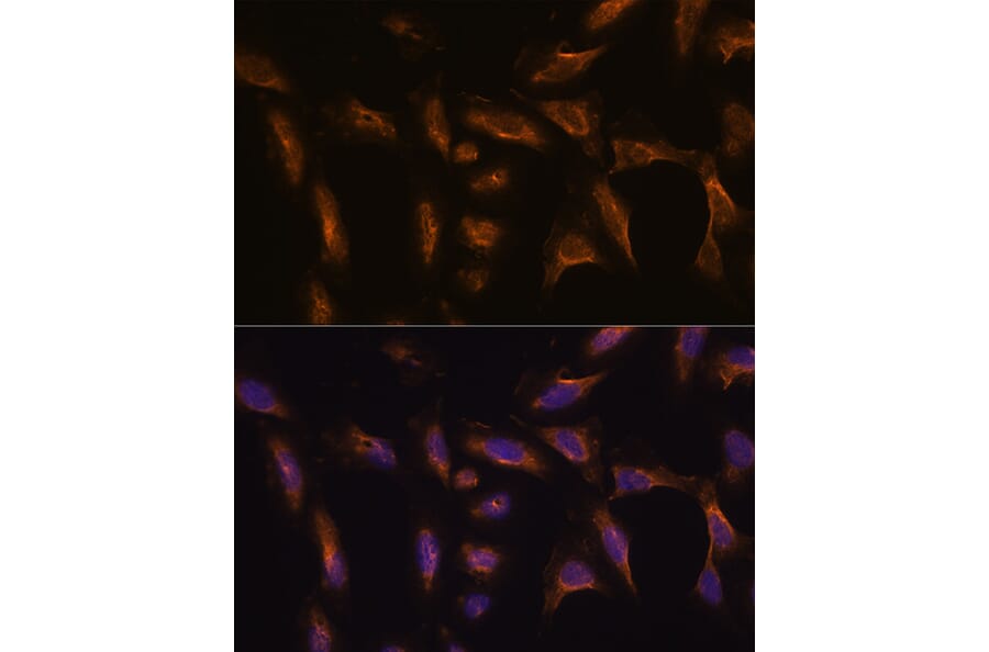 Immunofluorescence - Anti-MMP13 Antibody (A80887) - Antibodies.com