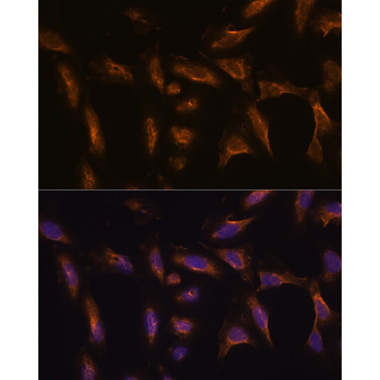 Immunofluorescence - Anti-MMP13 Antibody (A80887) - Antibodies.com