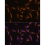 Immunofluorescence - Anti-MMP13 Antibody (A80887) - Antibodies.com