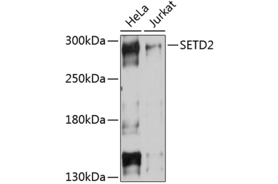 Western Blot - Anti-KMT3A/HYPB/HIF-1 Antibody (A80888) - Antibodies.com