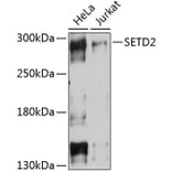 Western Blot - Anti-KMT3A/HYPB/HIF-1 Antibody (A80888) - Antibodies.com
