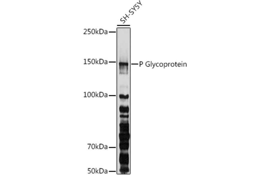 Western Blot - Anti-P Glycoprotein Antibody (A80889) - Antibodies.com