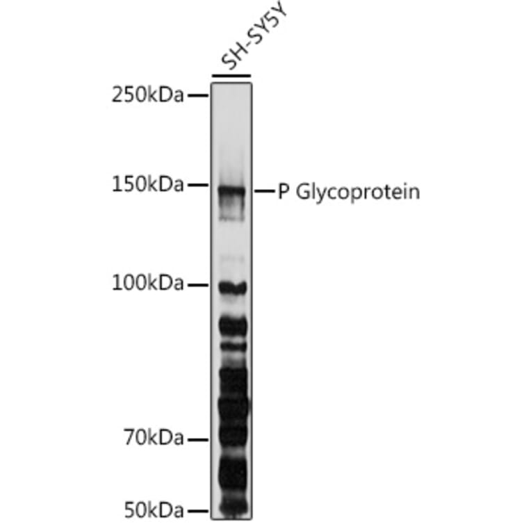 Western Blot - Anti-P Glycoprotein Antibody (A80889) - Antibodies.com
