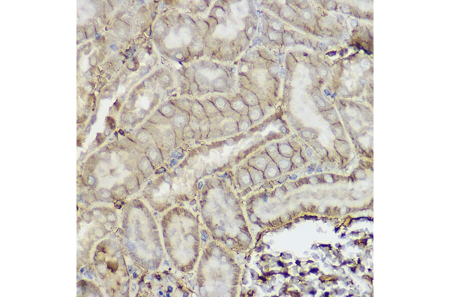 Immunohistochemistry - Anti-P Glycoprotein Antibody (A80889) - Antibodies.com