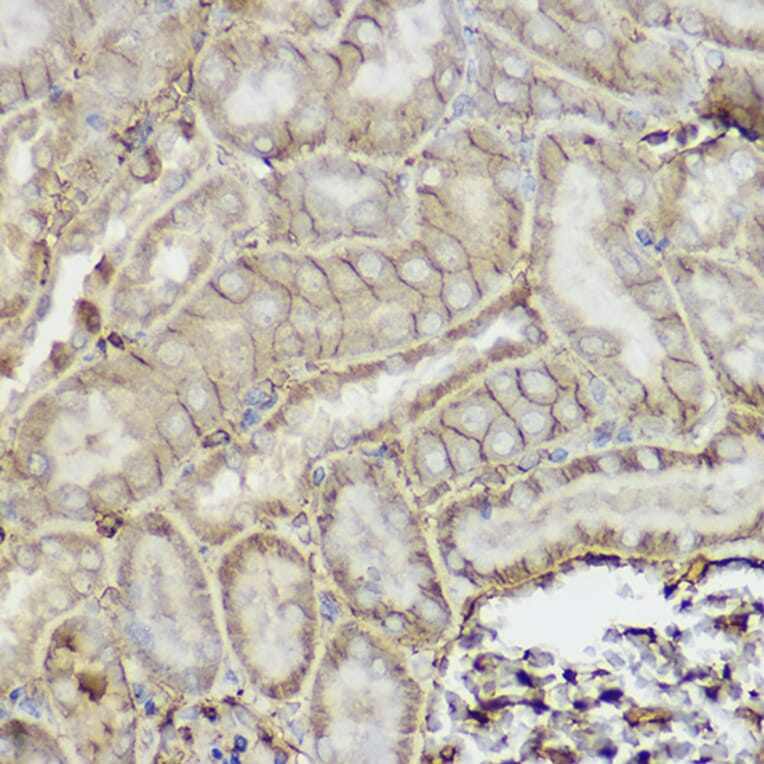 Immunohistochemistry - Anti-P Glycoprotein Antibody (A80889) - Antibodies.com