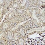 Immunohistochemistry - Anti-P Glycoprotein Antibody (A80889) - Antibodies.com