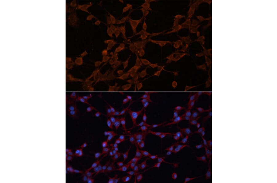 Immunofluorescence - Anti-P Glycoprotein Antibody (A80889) - Antibodies.com