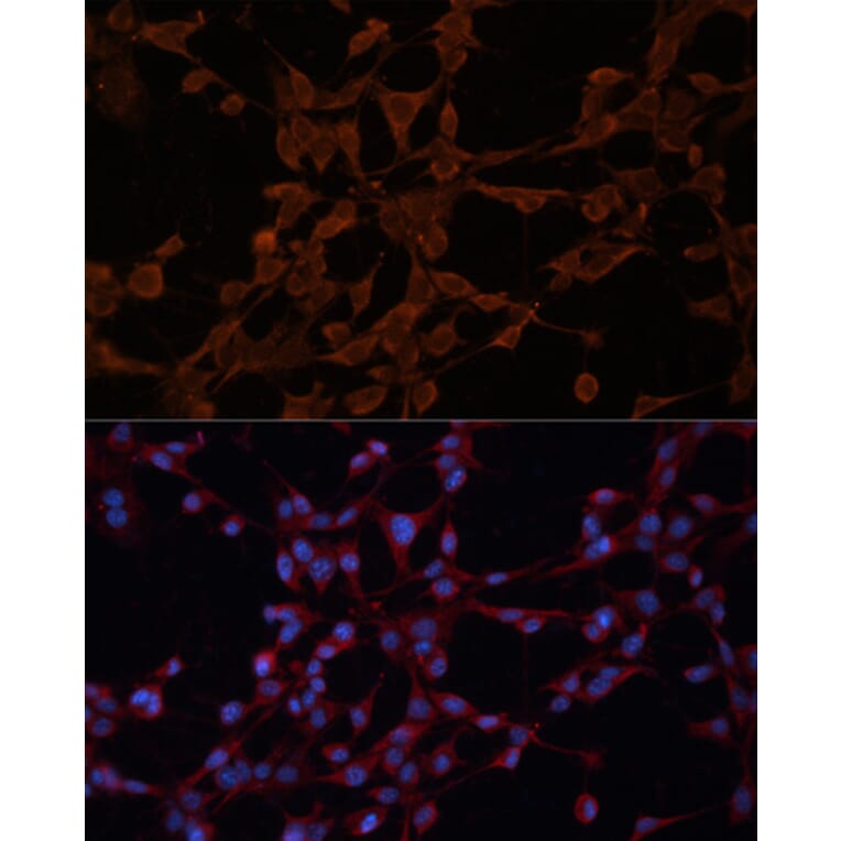 Immunofluorescence - Anti-P Glycoprotein Antibody (A80889) - Antibodies.com