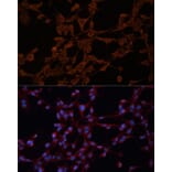 Immunofluorescence - Anti-P Glycoprotein Antibody (A80889) - Antibodies.com