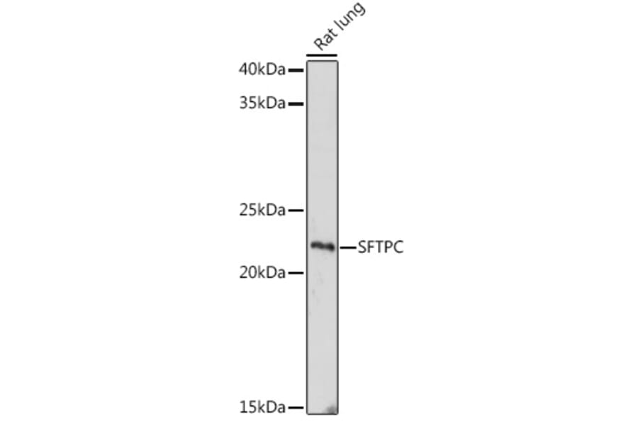 Western Blot - Anti-Prosurfactant Protein C Antibody (A80892) - Antibodies.com