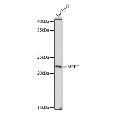 Western Blot - Anti-Prosurfactant Protein C Antibody (A80892) - Antibodies.com