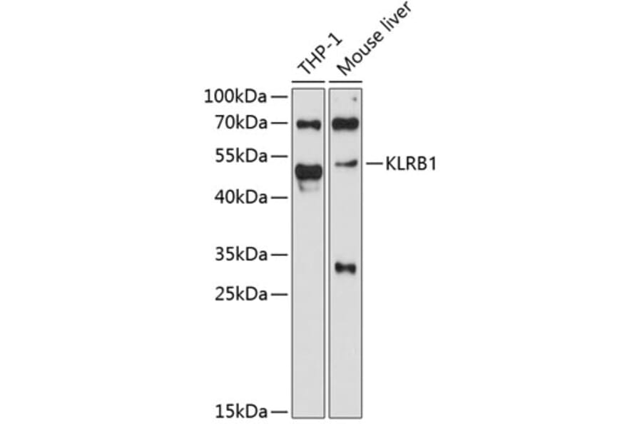 Western Blot - Anti-KLRB1 Antibody (A11783) - Antibodies.com