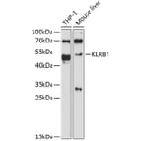 Western Blot - Anti-KLRB1 Antibody (A11783) - Antibodies.com