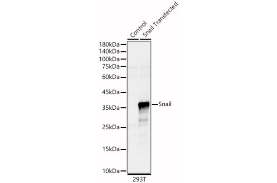 Western Blot - Anti-SNAIL Antibody (A80897) - Antibodies.com
