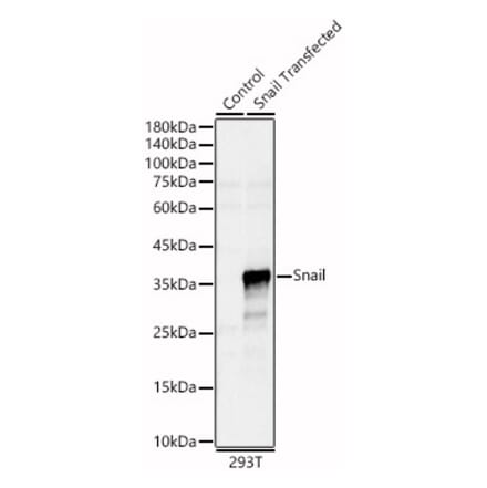 Western Blot - Anti-SNAIL Antibody (A80897) - Antibodies.com