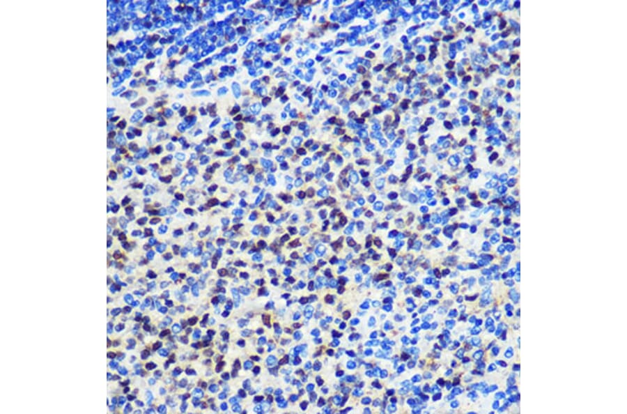 Immunohistochemistry - Anti-SNAIL Antibody (A80897) - Antibodies.com