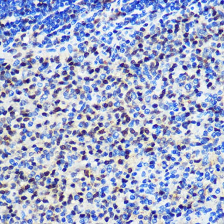 Immunohistochemistry - Anti-SNAIL Antibody (A80897) - Antibodies.com