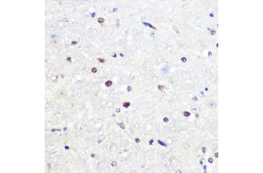 Immunohistochemistry - Anti-SNAIL Antibody (A80897) - Antibodies.com