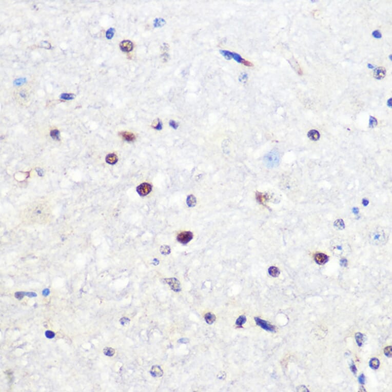 Immunohistochemistry - Anti-SNAIL Antibody (A80897) - Antibodies.com