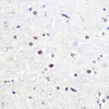 Immunohistochemistry - Anti-SNAIL Antibody (A80897) - Antibodies.com