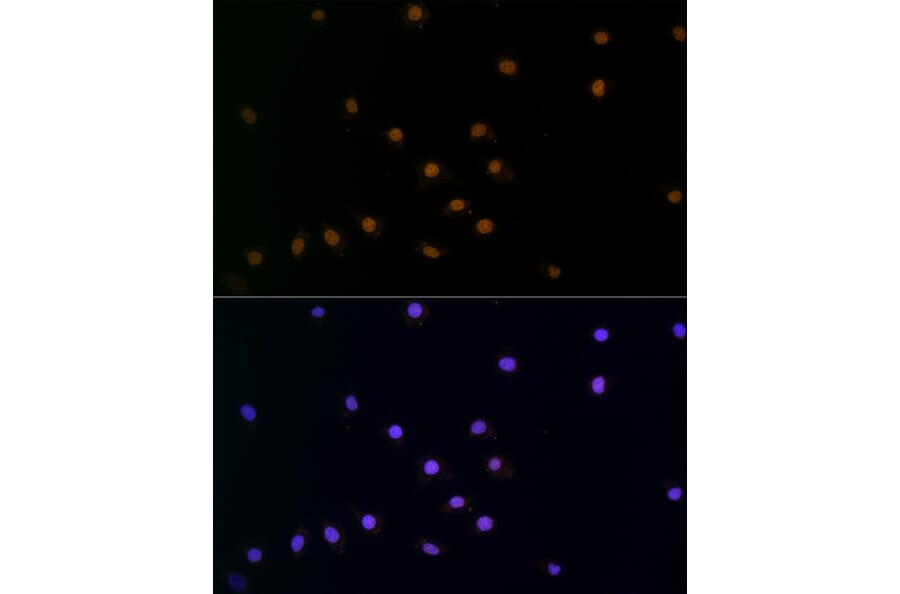 Immunofluorescence - Anti-SNAIL Antibody (A80897) - Antibodies.com