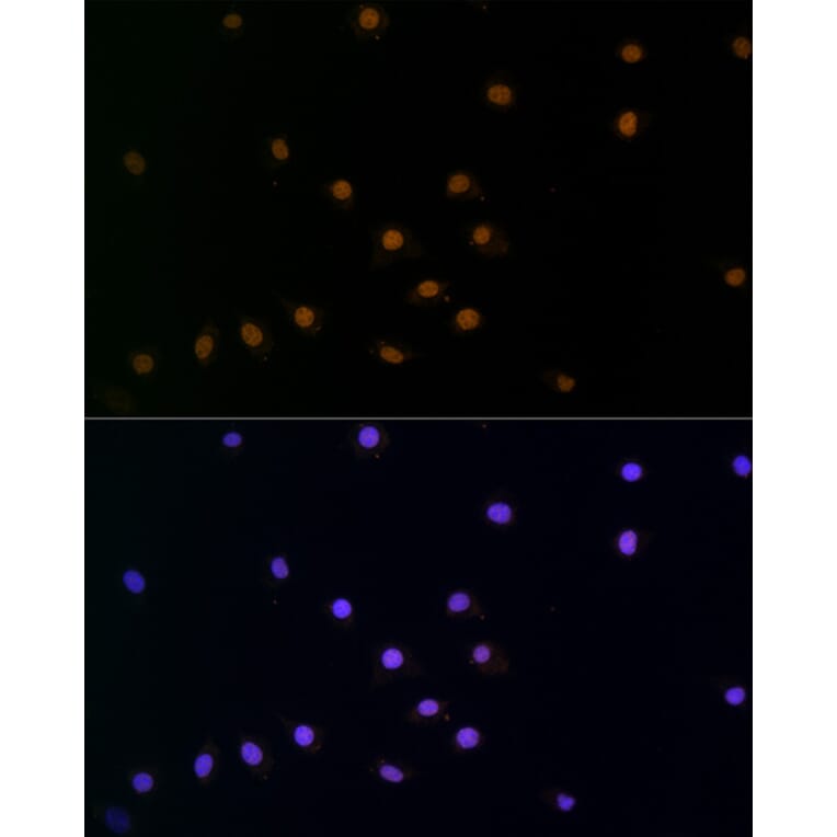 Immunofluorescence - Anti-SNAIL Antibody (A80897) - Antibodies.com