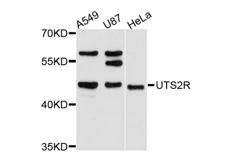Western Blot - Anti-UTS2R Antibody (A11811) - Antibodies.com