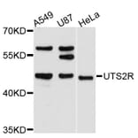 Western Blot - Anti-UTS2R Antibody (A11811) - Antibodies.com