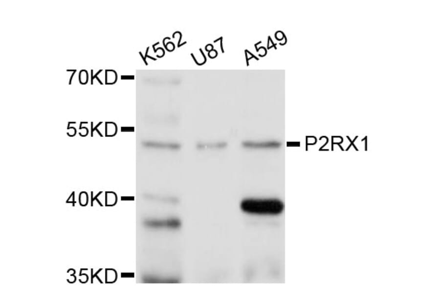 Western Blot - Anti-P2RX1 Antibody (A11817) - Antibodies.com
