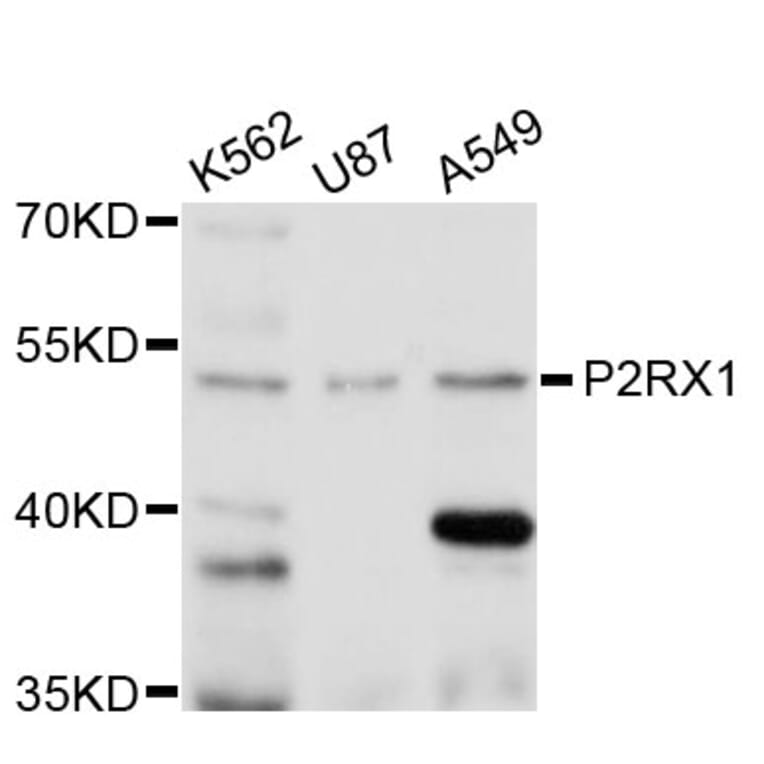 Western Blot - Anti-P2RX1 Antibody (A11817) - Antibodies.com