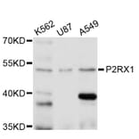 Western Blot - Anti-P2RX1 Antibody (A11817) - Antibodies.com