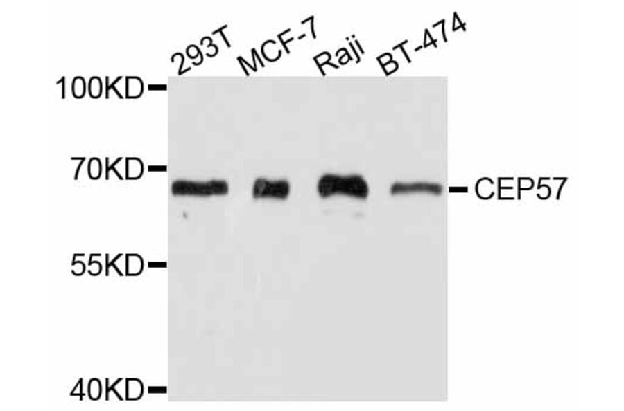 Western Blot - Anti-CEP57 Antibody (A11818) - Antibodies.com