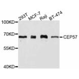 Western Blot - Anti-CEP57 Antibody (A11818) - Antibodies.com