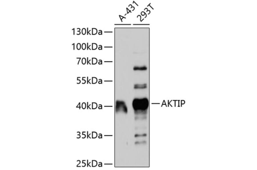 Western Blot - Anti-AKTIP Antibody (A11822) - Antibodies.com