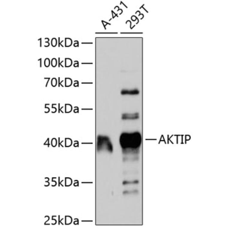 Western Blot - Anti-AKTIP Antibody (A11822) - Antibodies.com