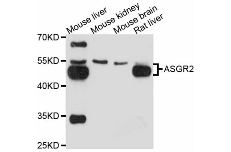Western Blot - Anti-ASGR2 Antibody (A11830) - Antibodies.com