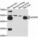 Western Blot - Anti-ASGR2 Antibody (A11830) - Antibodies.com