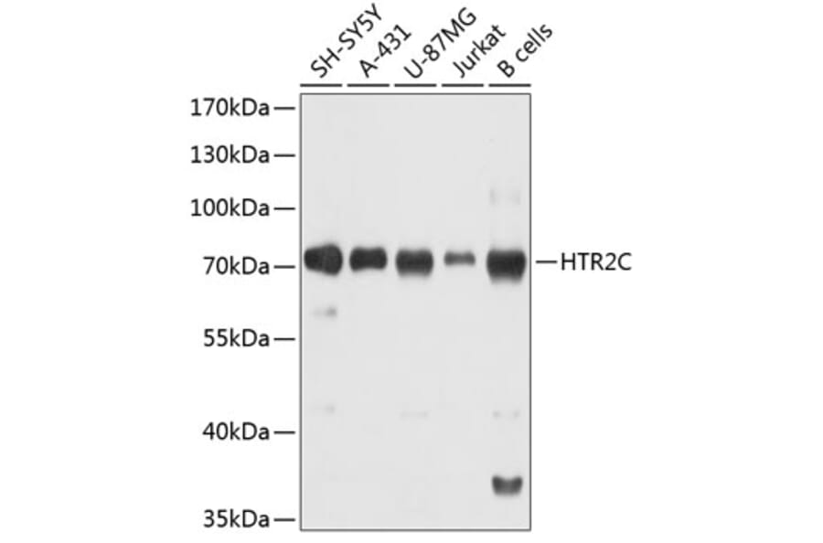 Western Blot - Anti-5-HT2C Receptor Antibody (A80905) - Antibodies.com