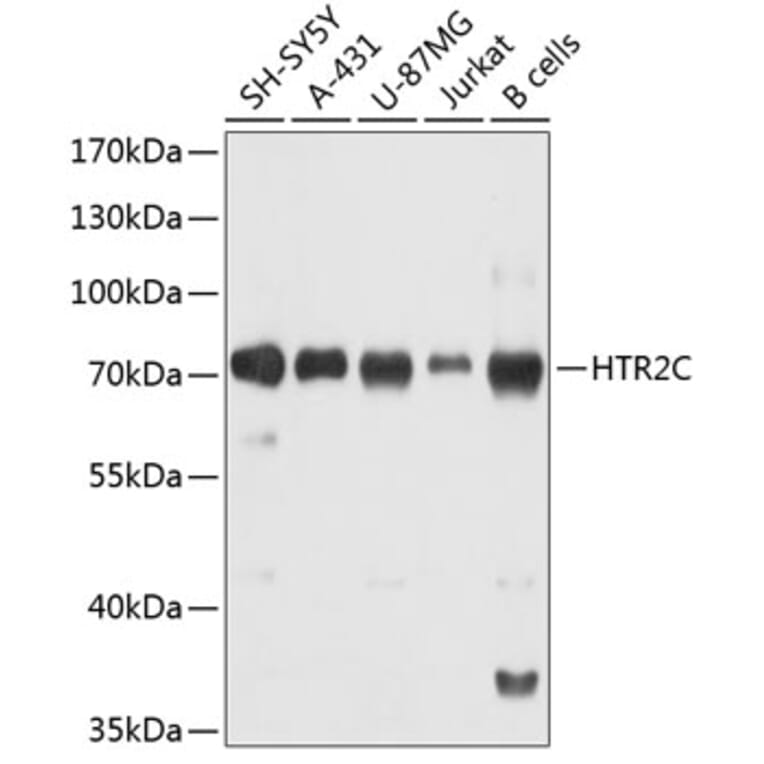 Western Blot - Anti-5-HT2C Receptor Antibody (A80905) - Antibodies.com