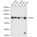 Western Blot - Anti-5-HT2C Receptor Antibody (A80905) - Antibodies.com