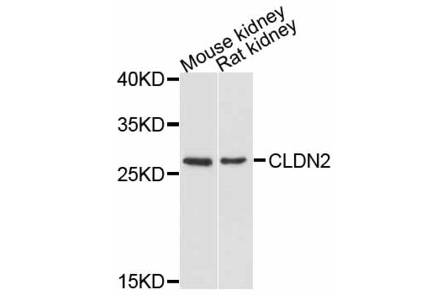 Western Blot - Anti-CLDN2 Antibody (A11843) - Antibodies.com