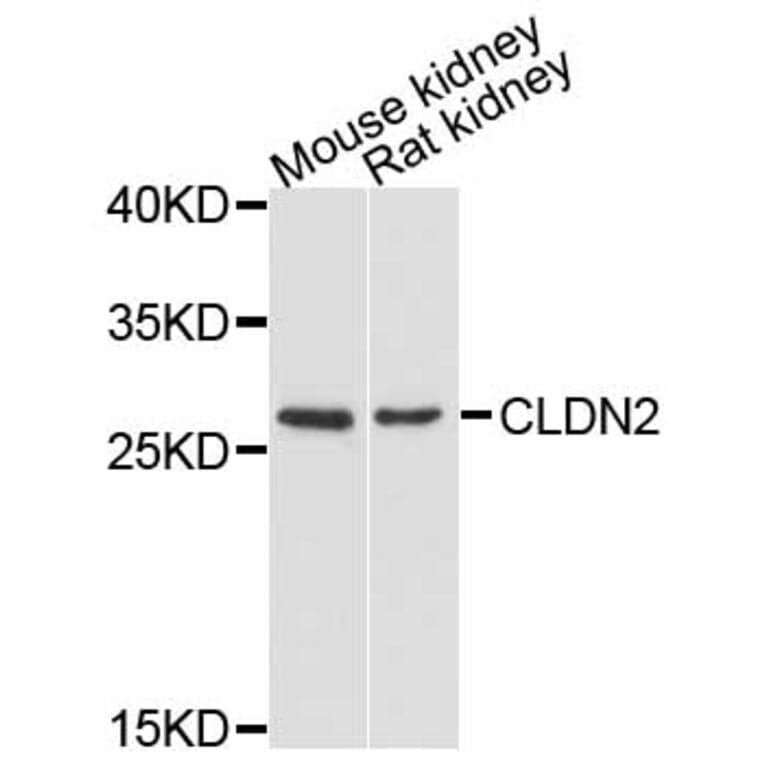 Western Blot - Anti-CLDN2 Antibody (A11843) - Antibodies.com