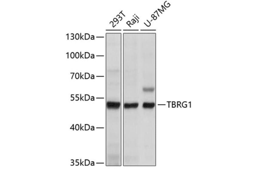 Western Blot - Anti-TBRG1 Antibody (A11844) - Antibodies.com