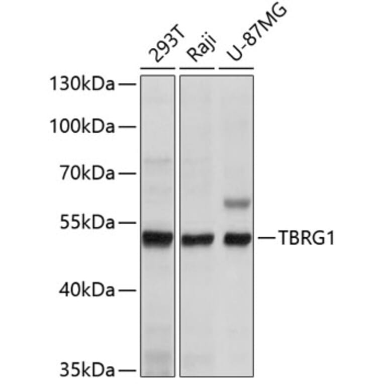Western Blot - Anti-TBRG1 Antibody (A11844) - Antibodies.com