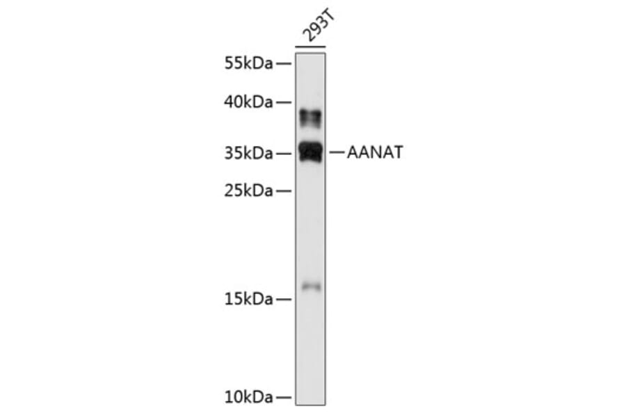 Western Blot - Anti-AANAT Antibody (A80908) - Antibodies.com