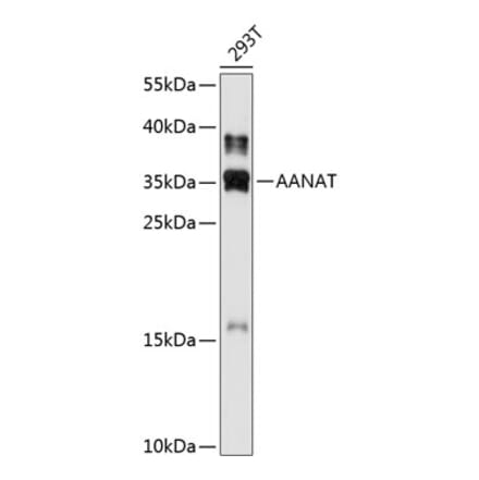 Western Blot - Anti-AANAT Antibody (A80908) - Antibodies.com