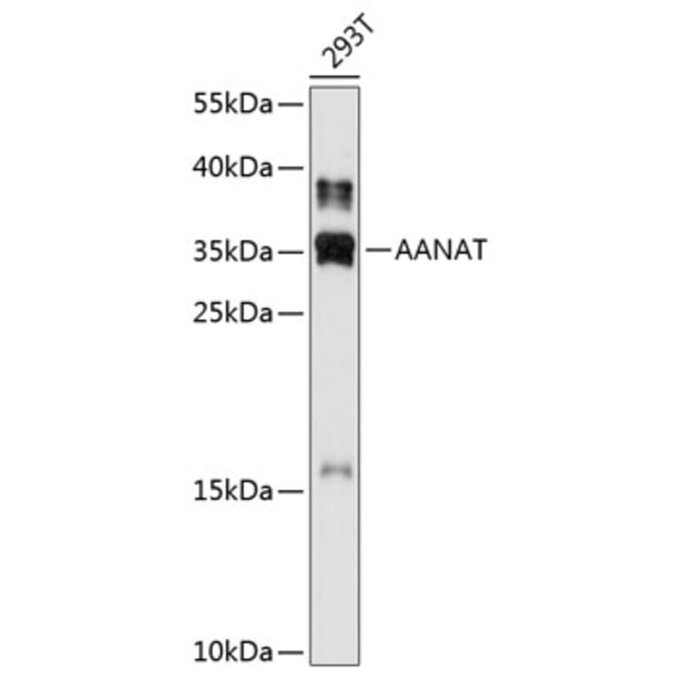 Western Blot - Anti-AANAT Antibody (A80908) - Antibodies.com