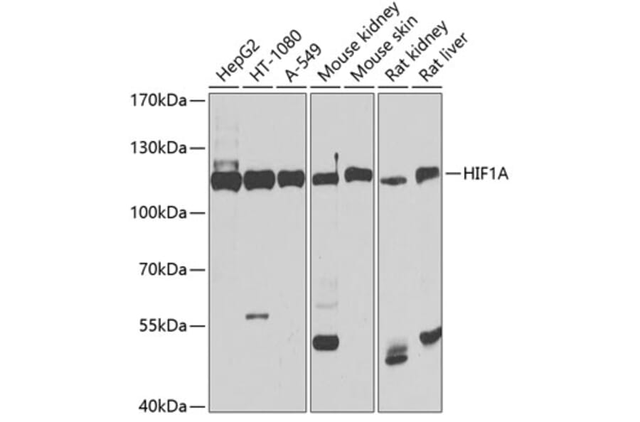 Western Blot - Anti-HIF1A Antibody (A11945) - Antibodies.com