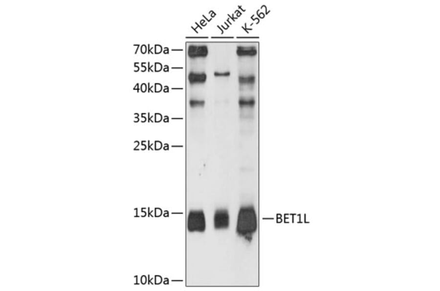 Western Blot - Anti-BET1L Antibody (A80912) - Antibodies.com